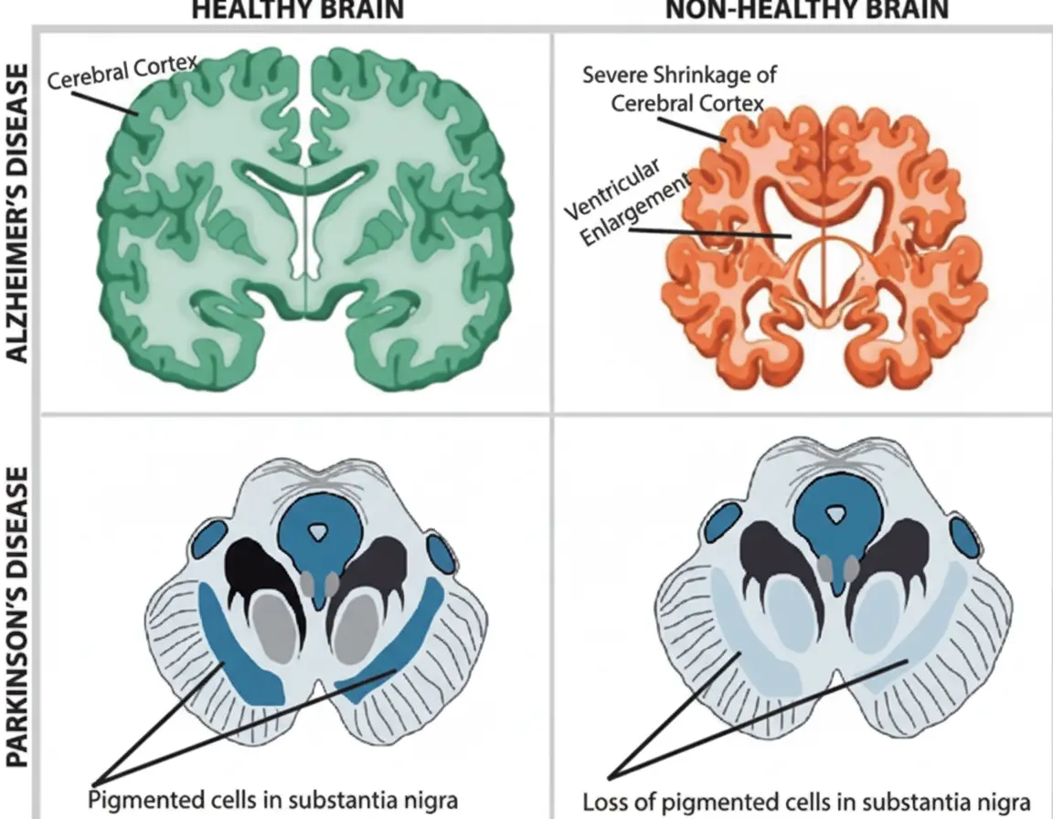 Role of Peptides in Neurological Disorders